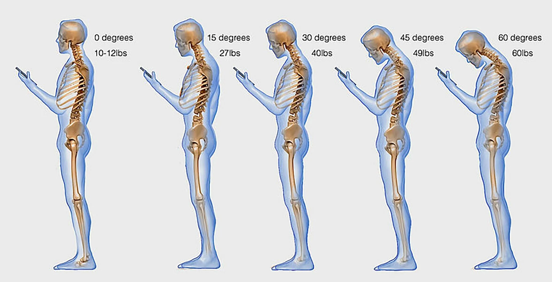 Нагрузка на позвоночник при наклоне головы. Нагрузка на позвоночник в зависимости от наклона головы. Нагрузка на шею при наклоне головы. Осанка. Осевые упражнения на позвоночник