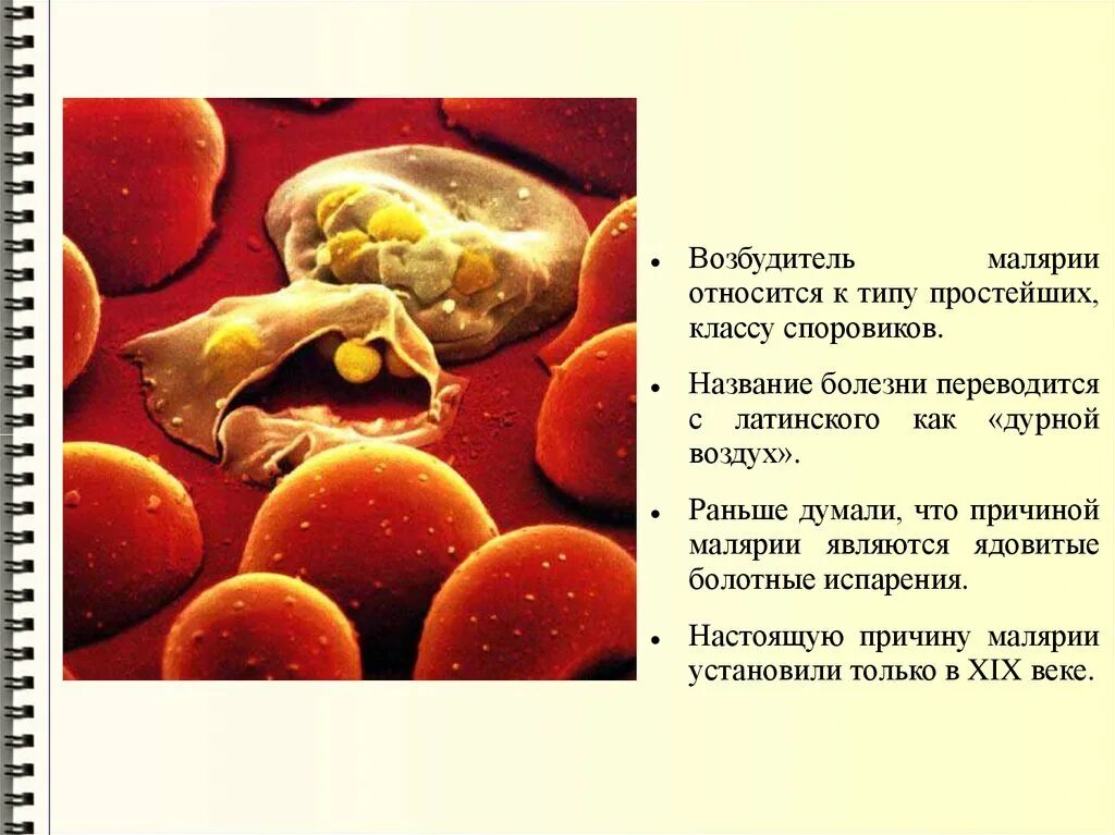 К заболеваниям вызываемым простейшими относятся. К заболеваниям вызываемым простейшими относятся. Малярия возбудитель заболевания. Бактерии являются возбудителями таких болезней. Малярийный плазмодий трипаносома лямблия.