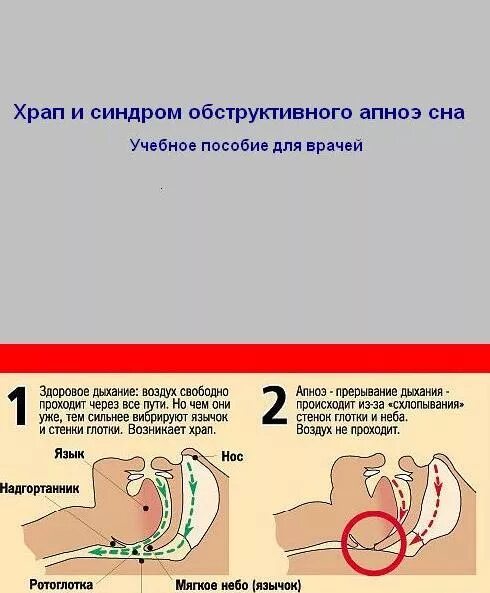 Почему храпит ребенок 7 лет. Причины храпа во сне. Храп у ребенка 6 лет во сне. Причины храпа у мужчин. Ребенок спит с открытым ртом.