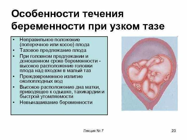 Самопроизвольное предлежание. Положение плода поперечное головное. Продольное головное предлежание плода. Продольное поперечное косое положение плода. Продольное положение плода при беременности в 32 недели.