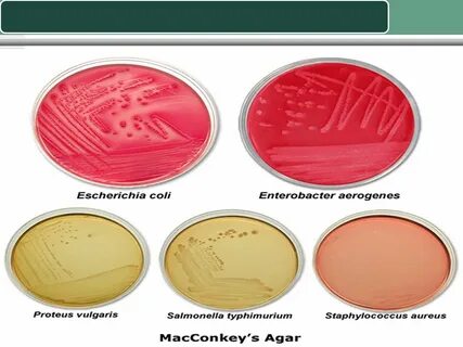 Escherichia coli в моче
