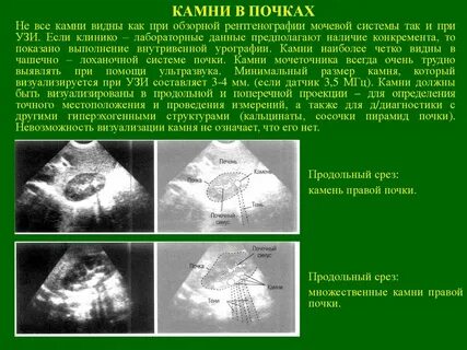 Узи почек при месячных можно