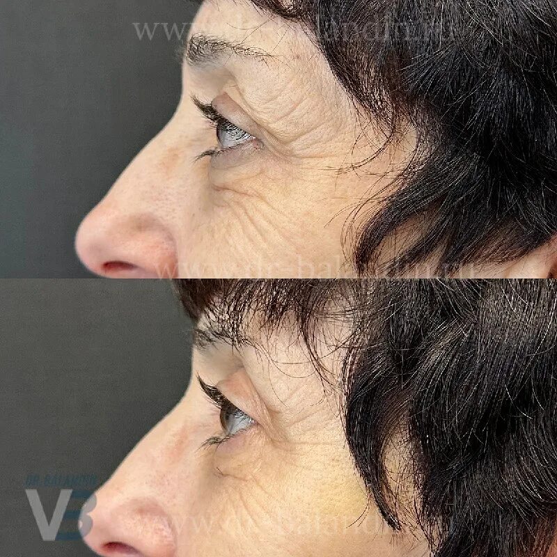 баландин пластический хирург