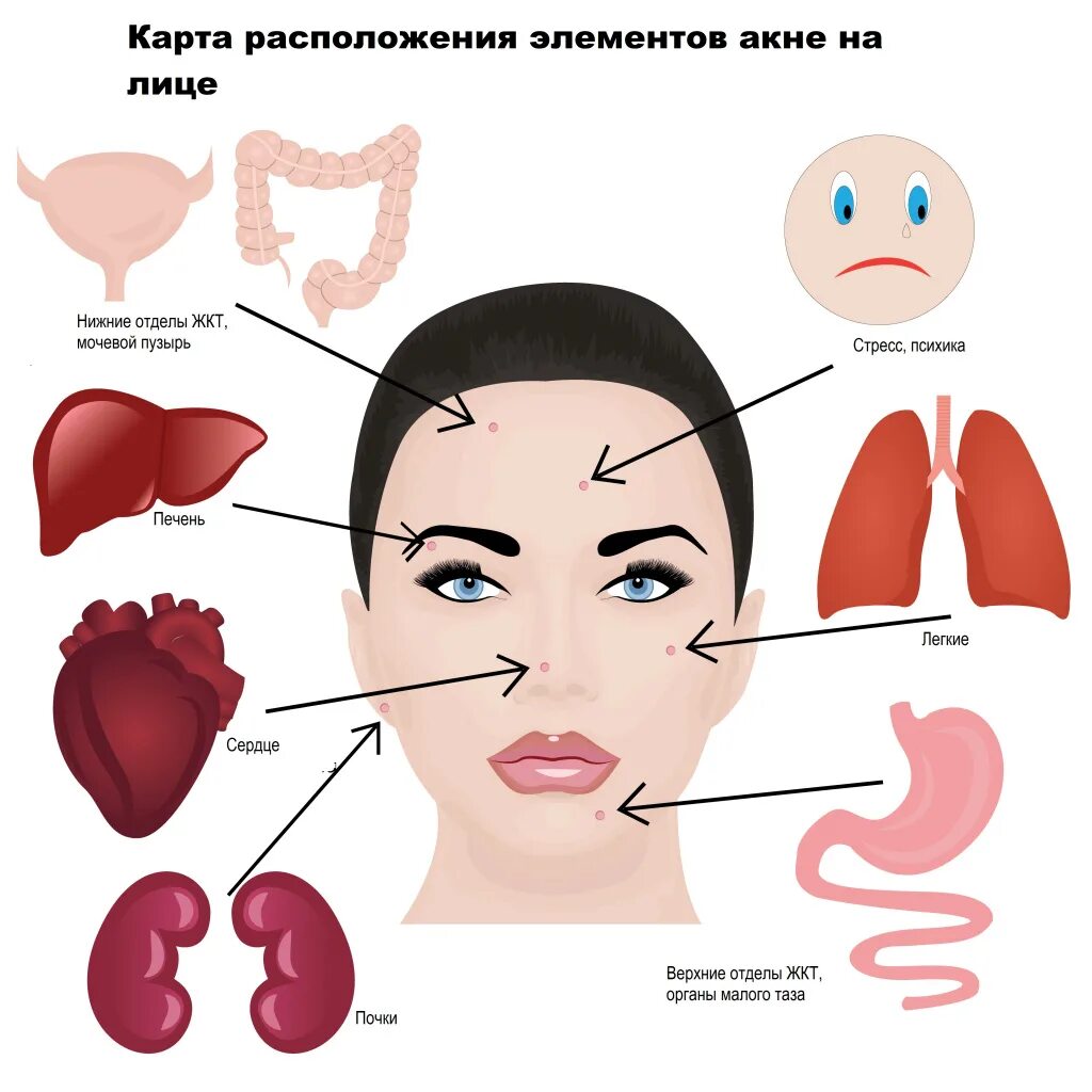 Прыщи какой орган страдает. Карта лица высыпания на лице. Прыщи схема расположения на лице.