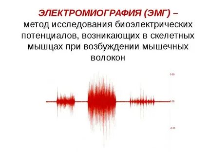 Электромиография принцип метода