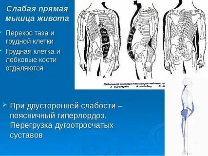 Причины слабых мышц