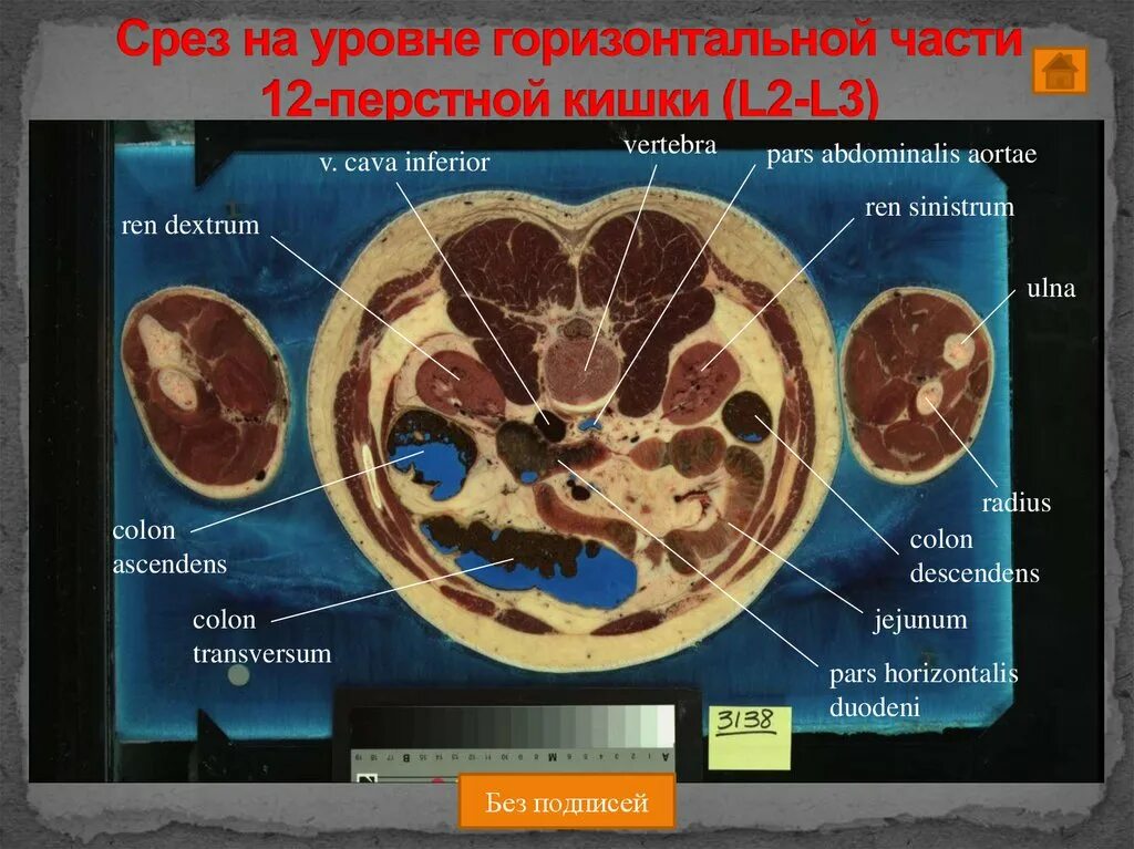 Срезы тела