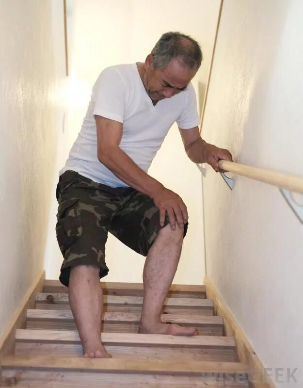 Больно ходить по лестнице. Больно ходить по лестнице. Knee pain at stairs. Больно ходить по лестнице. Колено лестницы.