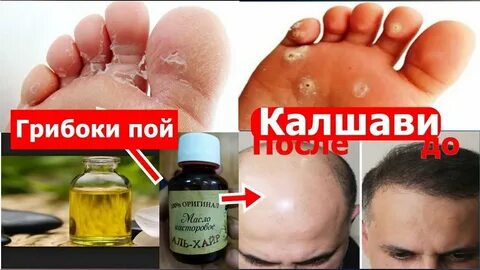 Барой чи