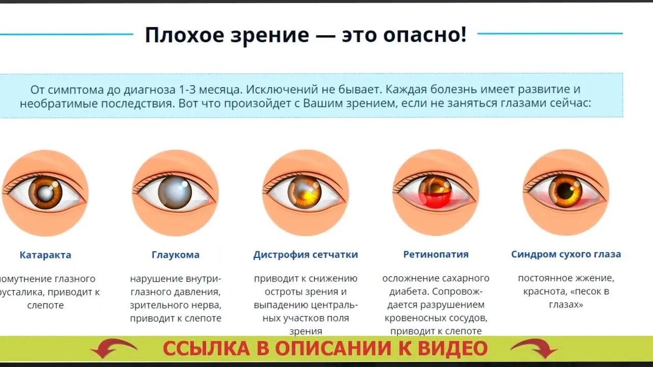 Морфологическая точка зрения. Катаракта глаза симптомы. Заболевание глаз глаукома. Катаракта – помутнение хрусталика глаза..