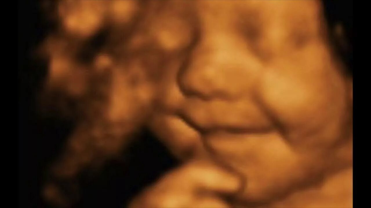 Ребенок в животе 34 недели. 3д УЗИ 33 недели беременности.