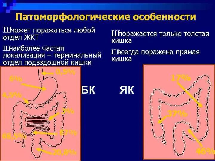 Подвздошная кишка