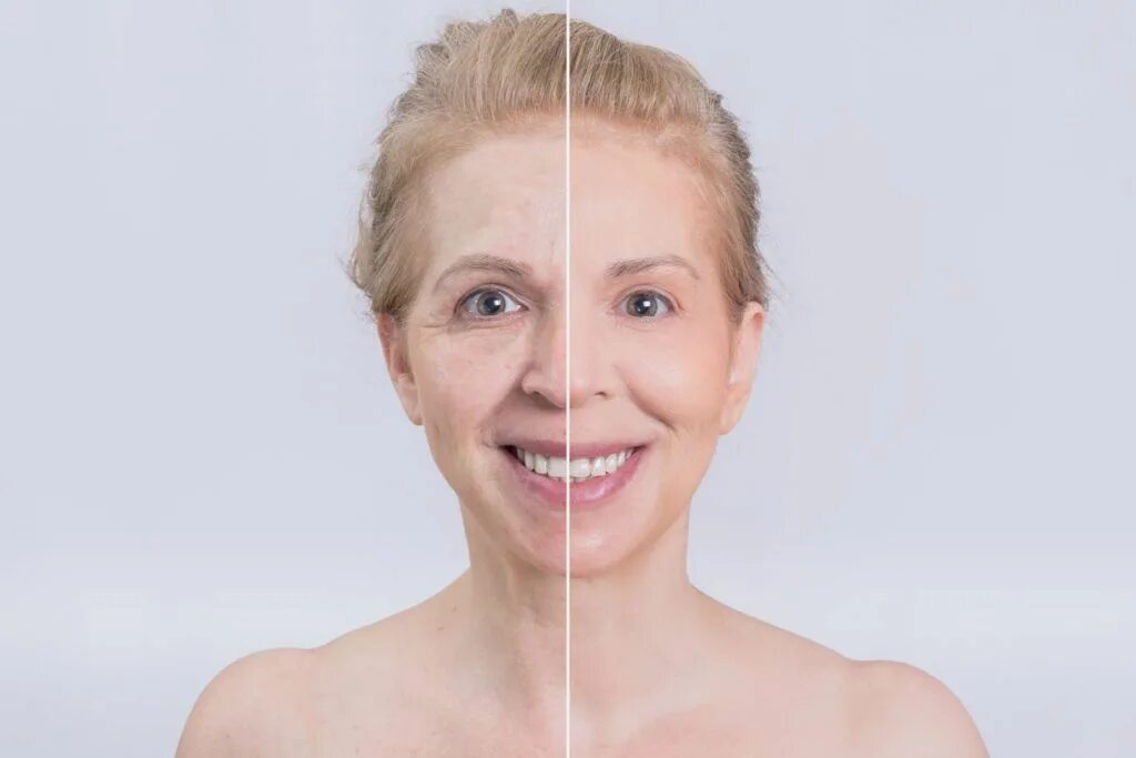 Solution aged