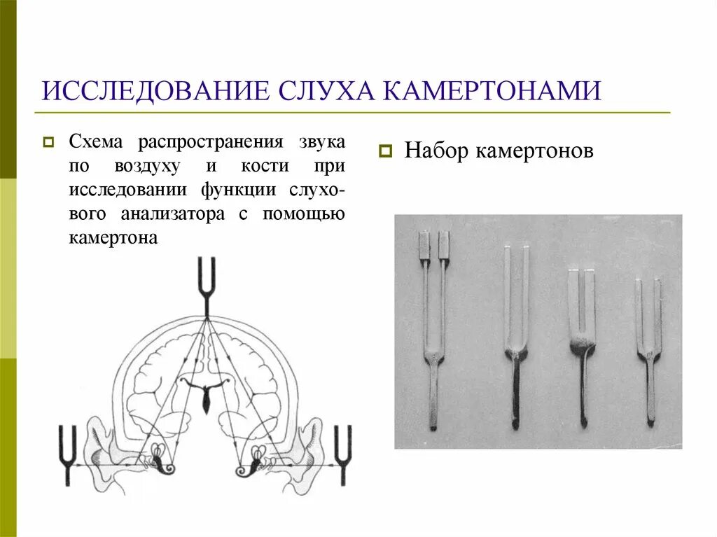 Исследование слуховой функции камертонами. Метод определения слуха с помощью камертонов. Исследование камертонами слуха опыт Ринне. Исследование воздушной проводимости камертонами.