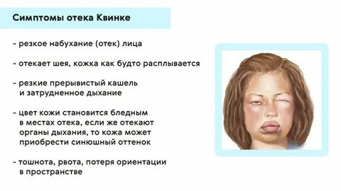 Отекает лицо и ноги у женщин причины