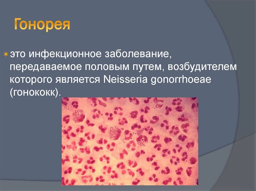 Нейссерия гонорея микробиология. Гонорея передается половым путем. Гонококки хламидии