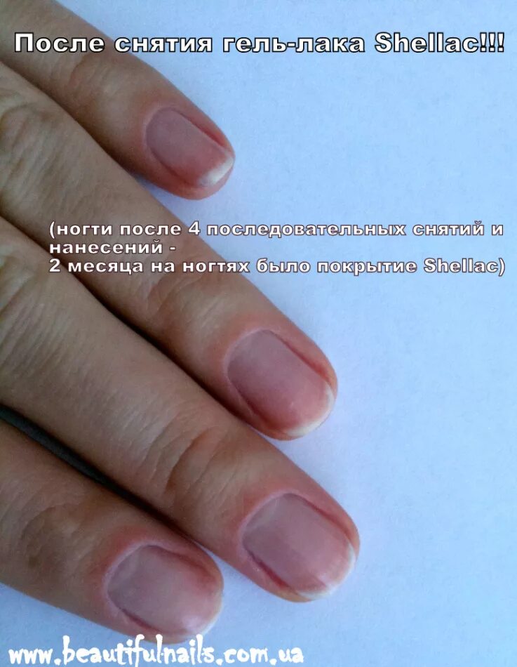 Вред шеллака для ногтей. Лак для ногтей после гель лака. покрытие после снятия гель лака. лак для ногтей после снятия гель лака. портятся ногти от гель лака.