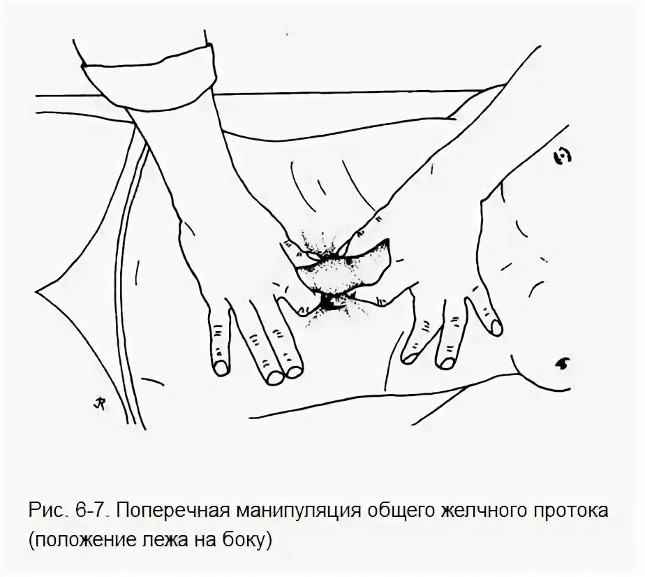 Висцеральный массаж желчный. Массаж желчного пузыря. массаж желчного пузыря при застое. массаж при застое желчи. мануальная терапия желчного пузыря.
