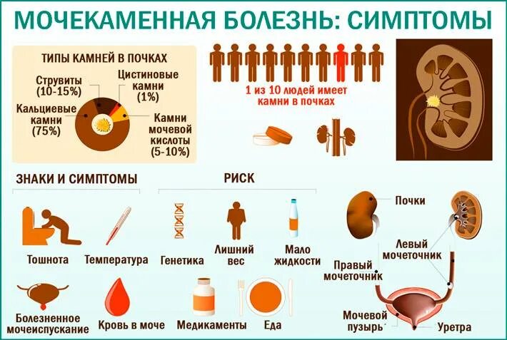 Мочекаменная болезнь врач