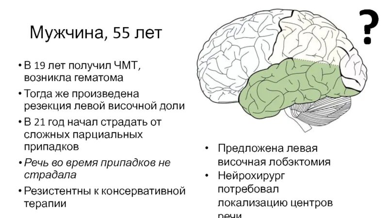Выберите височную долю
