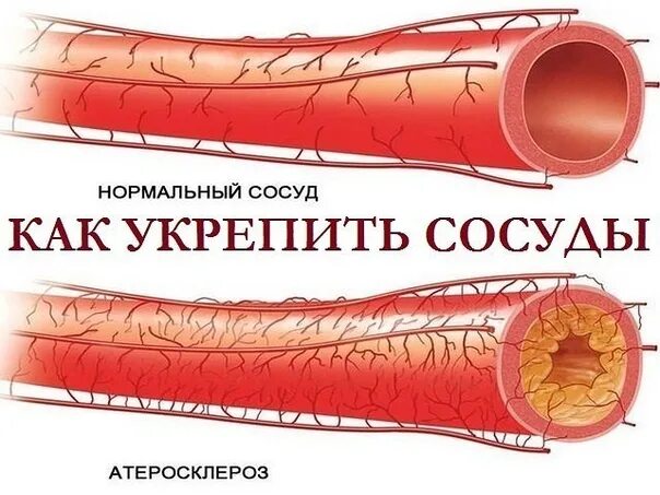 Как укрепить кровеносные сосуды