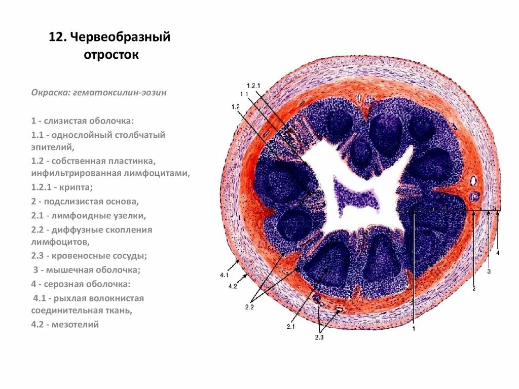 Строение аппендикса. Червеобразный отросток окраска гематоксилин-эозин. гистология червеобразного отростка аппендикса. червеобразный отросток гистология препарат. строение аппендикса гистология.