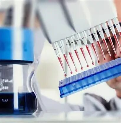Иммунологические исследования. ИФА лаборатория. Серологические исследования. Серологическое исследование крови.