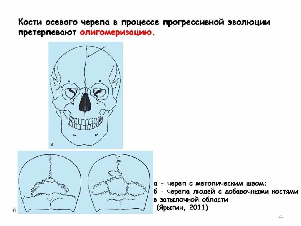 Черепная аномалия. Кости черепа аксиальная. Осевой череп.