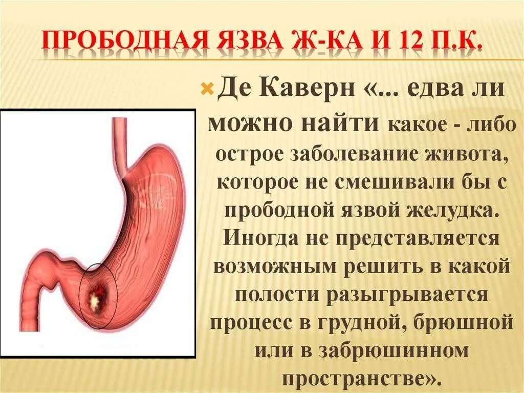 Язва желудка и 12 перстной кишки. Язва двенадцати двенадцатиперстная кишка. Перфоративная язва желудка и 12-перстной кишки. Перфорация язвы 12 перстной кишки. Язва симптомы и лечение у взрослых