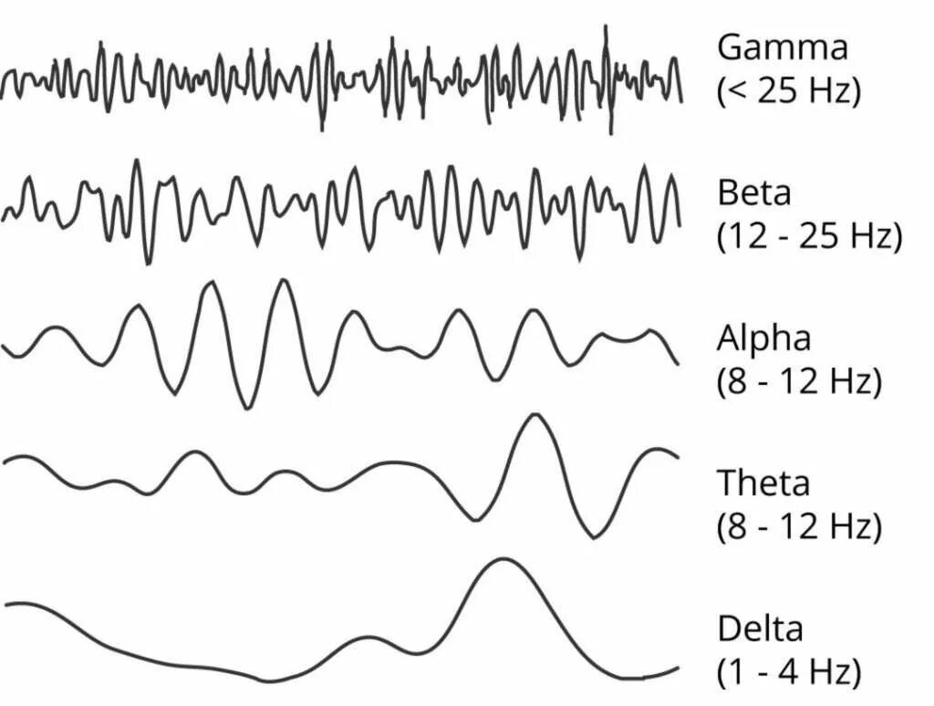 Частота ээг. Гамма ритм ЭЭГ частота. Частотный диапазон Альфа ритма на ЭЭГ. Альфа и бета ритмы на ЭЭГ. Альфа ритм ЭЭГ.