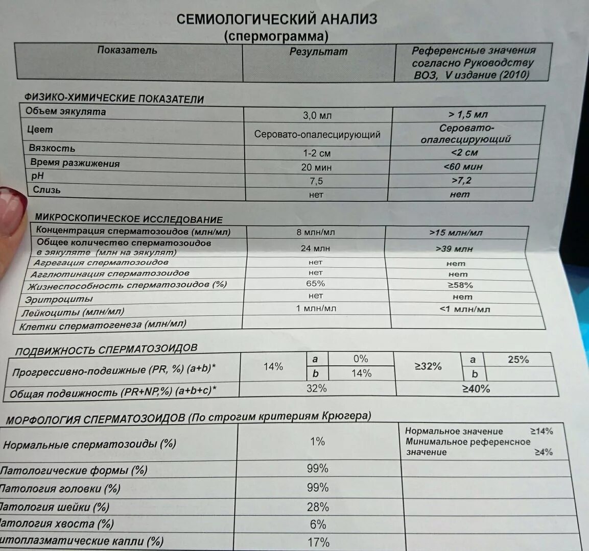Результаты теста спермограммы. Нормальные показатели микроскопического исследования спермограммы. спермограмма активноподвижные норма. анализ спермограммы норма. норма анализа на спермограмму.