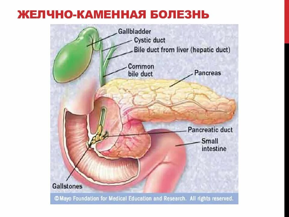 Колит желчный пузырь