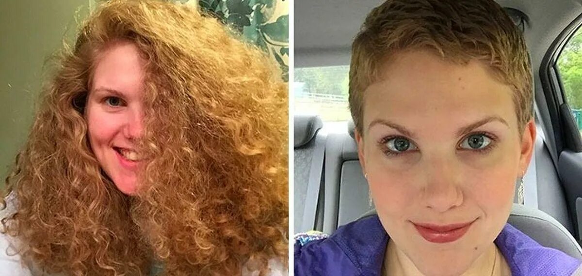 Нос после химиотерапии. Состричь сожженные волосы. Волосы после химиотерапии. Стрижка сожженных волос до и после. Девушки в париках до и после.