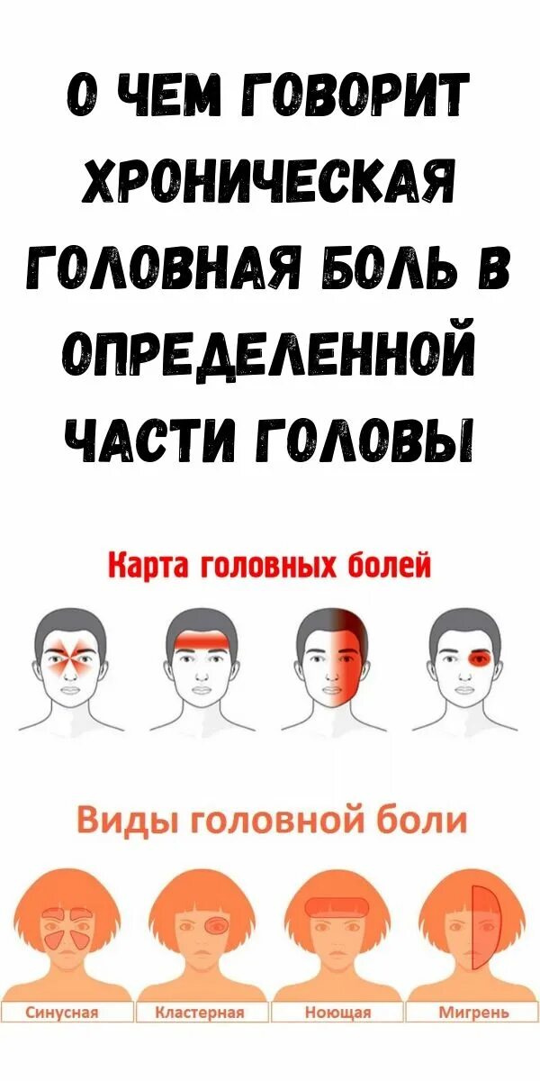 Болит затылок головы и виски причины. Головная боль части головы. Типы головной боли. Типы боли в голове. Головные боли в определенной части.