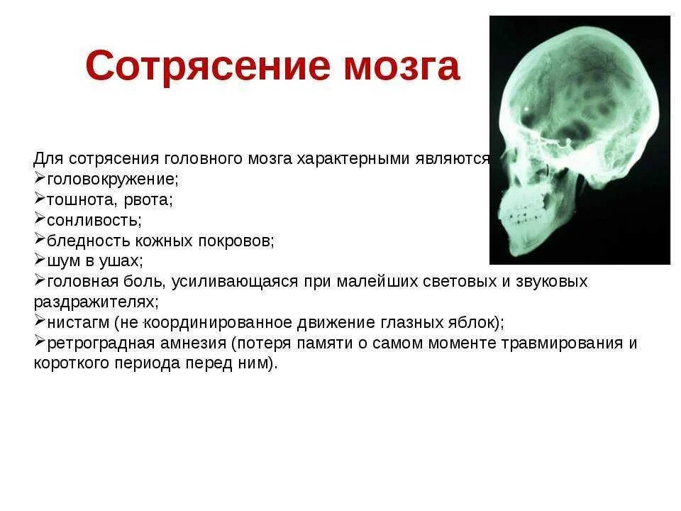 Признаки сотрясения головного мозга ответ на тест. Три основных признака при сотрясении головного мозга.. Симптомом сотрясения головного мозга является. Основной симптом сотрясения головного мозга. К симптомам сотрясения головного мозга относятся.