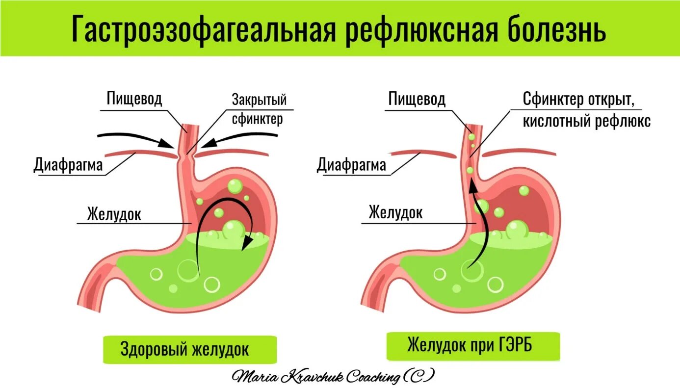 Болит пищевод что делать