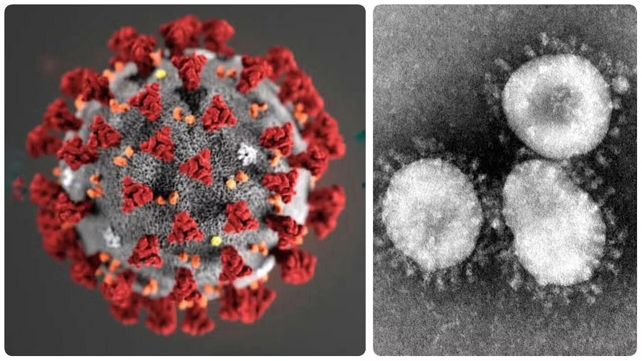 Коронавирус SARS cov 2 под микроскопом. Вирус гриппа под микроскопом и коронавирус. Вирус ковид под микроскопом. Вирус ковид 19. Коронавирус весной 2020 года