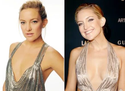 Kate hudson boob implants