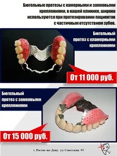 Протезирование отзывы пациентов