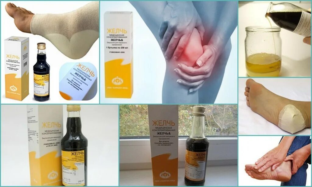 Желчь медицинская. Животная желчь. Желчь для суставов. Медицинская желчь крупного рогатого скота. Лечение суставов желчью.