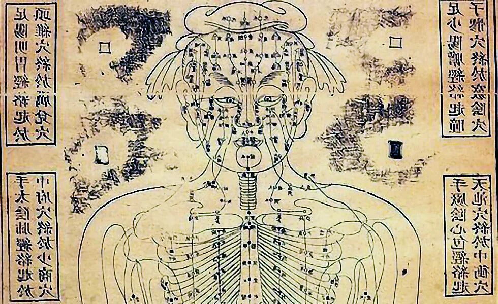 Иглоукалывание в древнем Китае. Древний Китай медицина акупунктура. Традиционная китайская медицина акупунктура. Иглоукалывание (акупунктура) в древнем Китае.