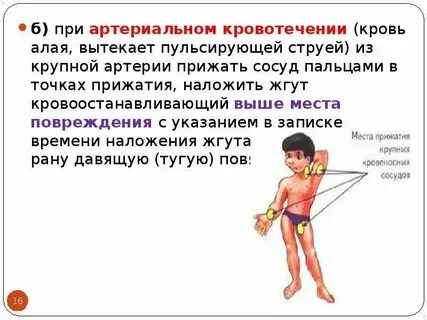 Время наложения жгута при артериальном кровотечении