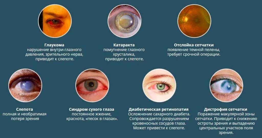Нарушение зрения. Заболевания глаз со слепотой. Причины глаукомы глаза