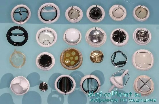 Файл:Bileafter prosthetic heart valve.jpg - Википедия