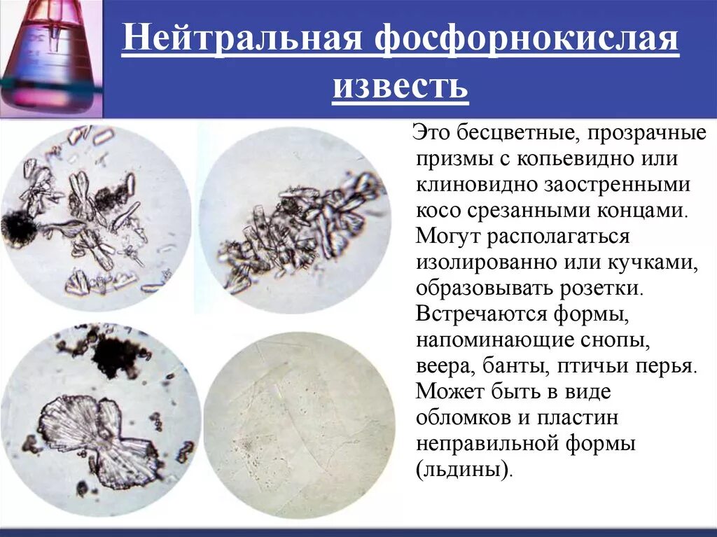 Фосфаты в какой моче. Нейтрально фосфорнокислая известь в моче. Аморфные фосфаты микроскопия мочи. Кристаллы фосфорнокислой извести в моче. Осадки мочи микроскопия.