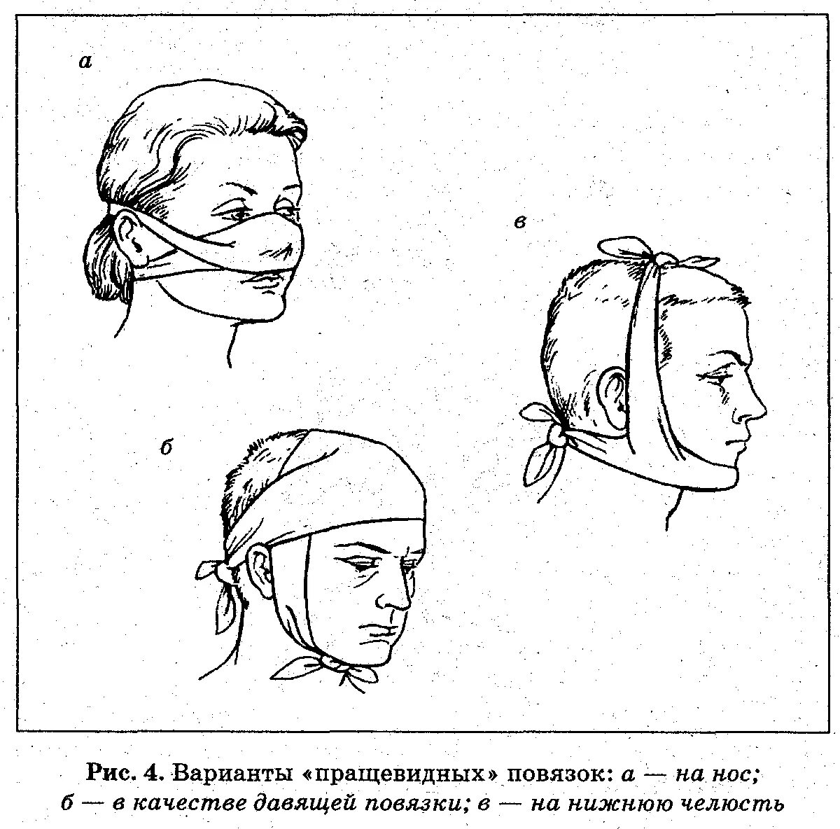 Медицинская помощь при травмах головы. Алгоритм оказания первой помощи при травмах головы. ПМП при черепно-мозговой травме. Оказание ПМП при черепно мозговой травме. Принципы оказания 1 помощи при черепно мозговой травме.