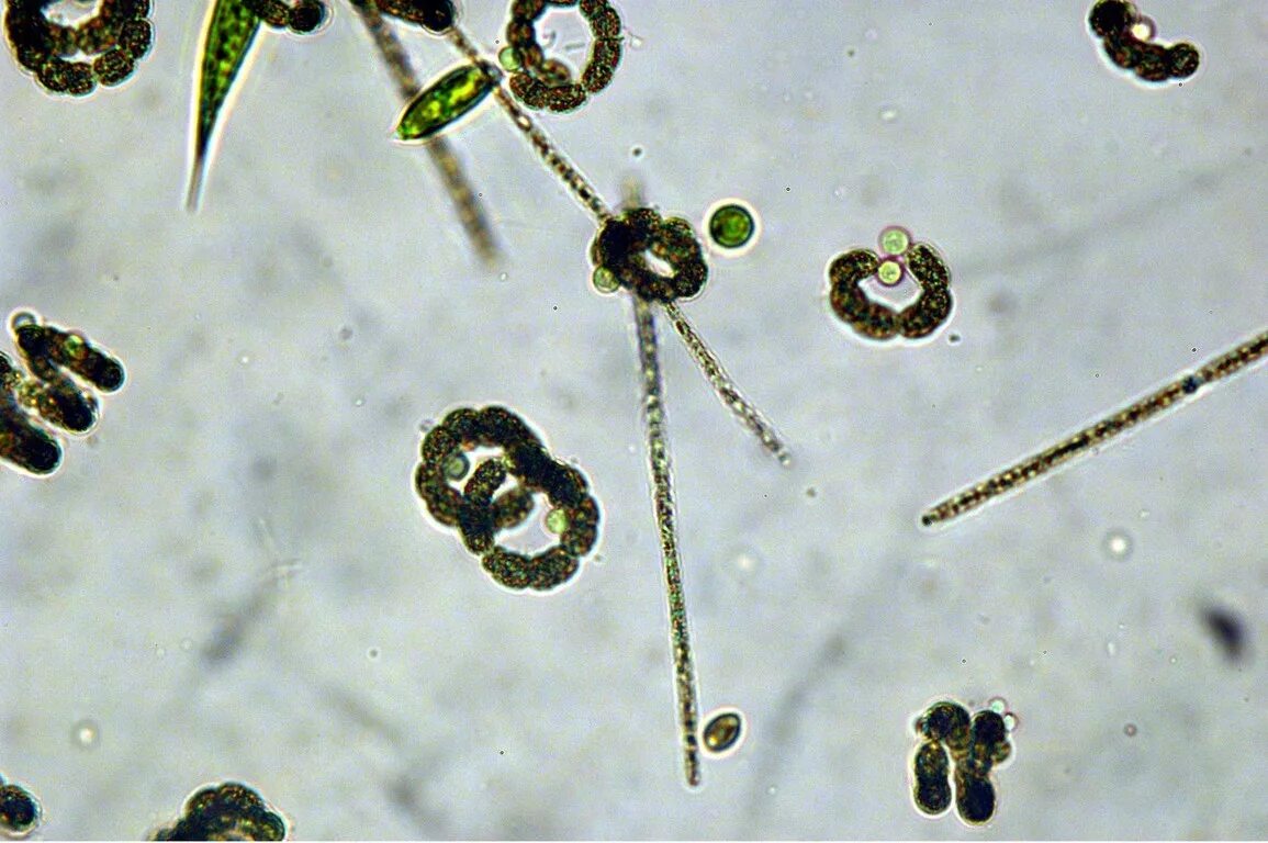 Фитопланктон водоросли. Диатомой планктон атлас. Хлорофиллы фитопланктона. Фитопланктон под микроскопом.