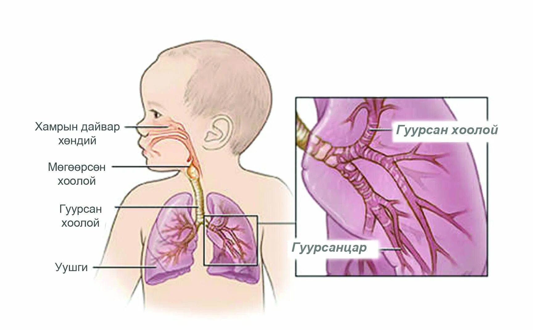 Бронхиты у грудных детей. Дыхательная система грудного ребенка. Органы дыхания у детей. Строение дыхательной системы у детей. Анатомия дыхательных путей у детей.