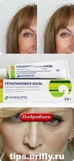 Гепариновая под глазами отзывы