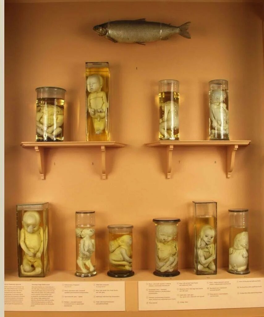 Петербург музей уродов. Петербург музей уродов. Кунсткамера коллекция уродцев. Петербург музей уродов. Музей петра 1 в санкт-петербурге уроды.